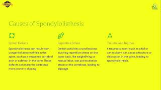 SPONDYLOLOISTHESIS CAUSES SYMPTOMS DIAGNOSIS TREATMENT  AIIAMS EDUCATION  IN HINDI  WITH NOTES [upl. by Irakuy]