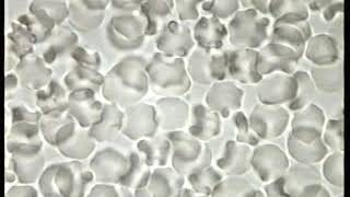 Blood in Hypertonic Solution produces crenated cells [upl. by Okim599]