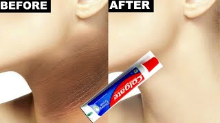 Colgate toothpaste for neck whitening  How to remove black neck with colgate  Colgate on neck [upl. by Veronique126]