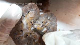 Human Cadaver Dissection  Kidney Overview [upl. by Onimixam]