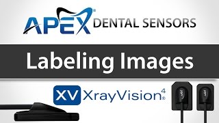 Apteryx XrayVision Labeling Images  Apex Dental Sensors  Training [upl. by Lletnuahs421]