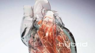 Glass Heart Hybrid Medical Animation HD [upl. by Monti]