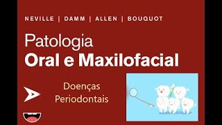 Doenças Periodontais  Gengivite [upl. by Neelon]