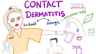 Irritant contact dermatitis overview causes symptoms treatment options and home remedies [upl. by Atnima568]