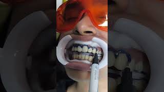 White teeth  Dontia Dental Care  Best Dental Clinic in Kolkata for teeth whitening dentist yt [upl. by Sualkin]