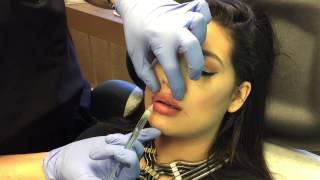 Gentle MicroDroplet Lip Injections by Clinical Injections Instructor Dr Naderi [upl. by Maillil]