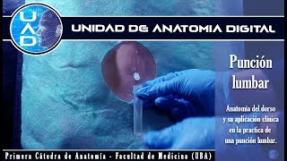 Punción Lumbar  Unidad de Anatomía Digital  Primera Cátedra de Anatomía  FMed  UBA [upl. by Magel]