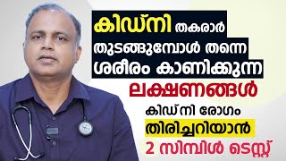 കിഡ്നി തകരാർ തുടങ്ങുമ്പോൾ തന്നെ ശരീരം കാണിക്കുന്ന ലക്ഷണങ്ങൾ  Kidney Disease Malayalam [upl. by Ellegna614]