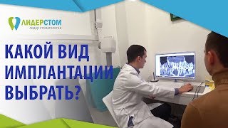 Виды имплантации зубов 👐 Подробно о всех видах и этапах имплантации зубов ЛидерСтом 12 [upl. by Pennie613]