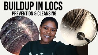 HOW TO GET RID OF DANDRUFFDRY SCALP WITH LOCS [upl. by Aurelea]