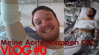 VLOG 0  Meine Aortenklappen OP und wie es mir so erging [upl. by Ttayw]