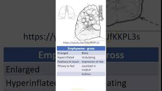 Patterns in Pathology Emphysema Dr GSS SRM MCH RC httpsyoutubeZVkJfKKPL3s [upl. by Melba551]