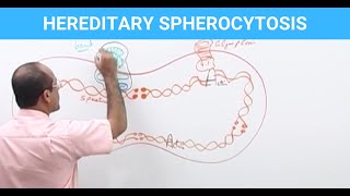 Hereditary Spherocytosis  Diagnosis amp Treatment  Genetics👨‍⚕️ [upl. by Oibesue]