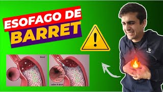 ❌ESOFAGO DE BARRET ¿Qué es Causas  Síntomas  Tratamiento [upl. by Nalla]