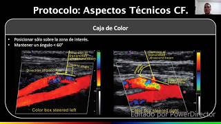 Doppler Arterias Carótidas y Vertebrales  Dr Daniel Sandoval Guerra [upl. by Melantha]