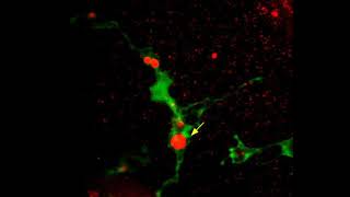 Microglial acidification [upl. by Adaval]