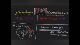 Difference Between Hematuria amp Hemoglobinuria [upl. by Tama538]