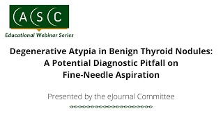 Degenerative Atypia in Benign Thyroid Nodules A Potential Diagnostic Pitfall on [upl. by Trebor]