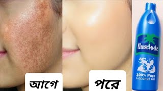 রাতে ঘুমানোর আগে নারকেল তেল এভাবে লাগান ত্বক ধকধবে ফর্সা উজ্জ্বল হবে coconut oil uses glowing skin [upl. by Malley]