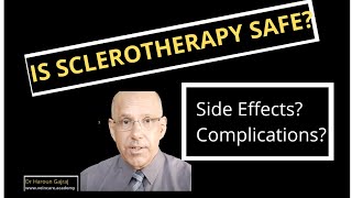 Is Sclerotherapy Safe  Side Effects and Complications of Sclerotherapy [upl. by Zawde]