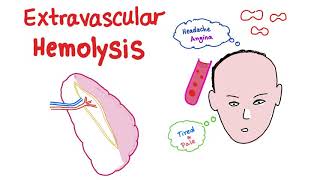 Hemolytic Anemia  Hematology  Part 1🩺 [upl. by Mildrid]