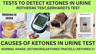 TESTS TO DETECT KETONES IN URINEROTHERAS TESTGERHARDTS TEST AND REAGENT STRIP TEST FOR KETONES [upl. by Lajes730]