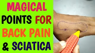 Acupressure Points For BACK PAIN RELIEF SCIATICA Sciatica LEG PAIN Sciatica NERVE PAIN RELIEF [upl. by Nura]