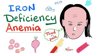 Iron Deficiency Anemia  All you need to know  Causes Symptoms Diagnosis Treatment [upl. by Sivraj]