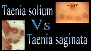 Difference between Taenia solium and Taenia saginata  Tsolium Vs Tsaginata [upl. by Eleinad]