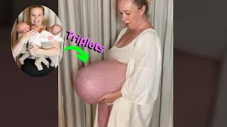 Moms baby bump that goes Straight Out goes Viral Triplets [upl. by Oiciruam]