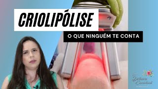 CRIOLIPÓLISE  O QUE NINGUÉM TE CONTA 😲🧊 [upl. by Llerreg]