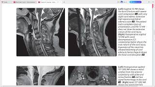 SPINE IMAGING DIAGNOSTIC IMAGING SERIES [upl. by Issiah]