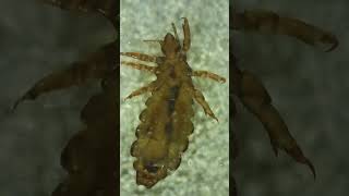 What Do Head Lice Really Look Like Under a Microscope [upl. by Elenaj140]