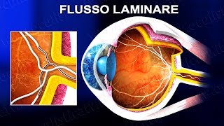 Angiografia a fluorescenza FAG e con verde indocianina ICGA wwwoculisticaTVit [upl. by Annoved]