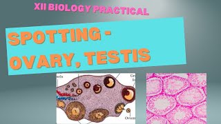 Spotting TS Testis Ovary XII Biology Practical [upl. by Elia]