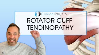 Rotator Cuff Tendinopathy  Expert Explains Mechanism Of Injury and Rehab Plan [upl. by Hubey808]