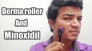 How to use dermaroller with minoxidil for beard growth   Tamil [upl. by Asilenna766]