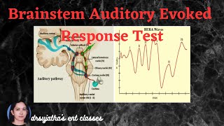 210Brainstem Evoked Response Audiometry BERA Part 22 bera oae screening [upl. by Hgielrac]