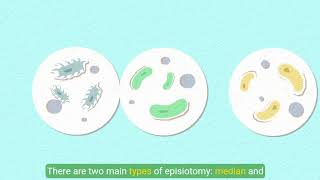 Understanding Episiotomy [upl. by Ettelrac]