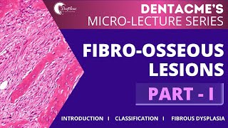 FIBROOSSEOUS LESIONS PARTI by DentAcme neetmdslectures neetmds inicetmds inbde afk adc [upl. by Zelma725]