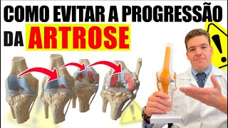 Aula 3 Como evitar a progressão da Artrose [upl. by Inalel559]