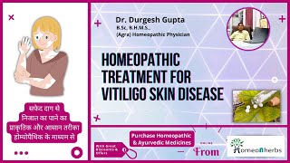 Homeopathic Treatment For Vitiligo  Homeonherbs [upl. by Cad]