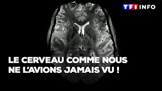 Le cerveau comme nous ne lavions jamais vu  Les images inédites de lIRM le plus puissant du monde [upl. by Aetnahc689]