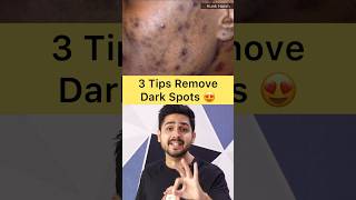 Remove Dark Spots Pimple Marks From Face darkspots skincare tips shorts [upl. by Eniamreg]