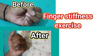 Post operative finger stiffness exercises [upl. by Schoof668]