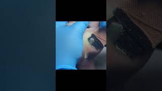 Charming pedicure video  Remove dead skin [upl. by Ademordna206]