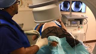 Genicular Nerve Ablation for knee pain [upl. by Airdnaed]