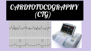 Cardiotocography CTG INTERPRETATION gynaecology obstetrician labour ctg [upl. by Acirederf]