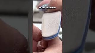 Dont just pick at your nail please Watch this nails [upl. by Sochor11]