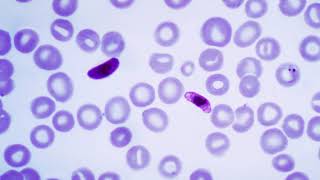 Plasmodium falciparum biology  Wikipedia audio article [upl. by Ainit]